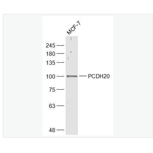 Anti-PCDH20 antibody-原钙粘附蛋白20抗体