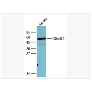 Anti-C9orf72 antibody-9号染色体开放阅读框72抗体,C9orf72