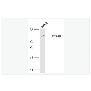 Anti-HOXA6 antibody-同源盒基因HOXA6蛋白抗体