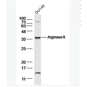 Anti-Arginase IIantibody-精氨酸酶2抗体