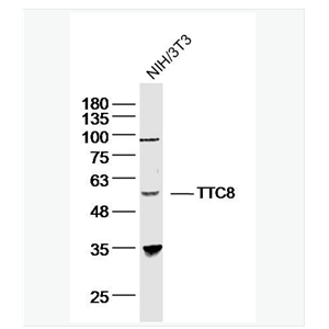 Anti-TTC8 antibody-巴尔得-别德尔综合征相关蛋白8抗体