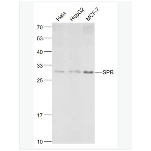 Anti-SPR  antibody-墨蝶蛉还原酶抗体