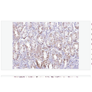 Anti-LIM kinase 1 + 2  antibody-单丝氨酸蛋白激酶1+2抗体