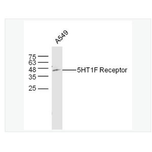 Anti-5HT1F Receptor antibody-5-羟色胺受体1F抗体,5HT1F Receptor