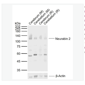 Anti-Neurabin 2  antibody-5-神經(jīng)組織特異性F肌動(dòng)蛋白結(jié)合蛋白2抗體,Neurabin 2