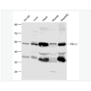 Anti-PD-L1antibody-程序性死亡配体1（CD274）抗体