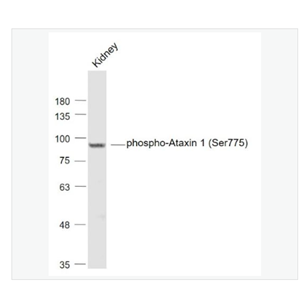 Anti-phospho-Ataxin 1 antibody-磷酸化脊髓小脑失调症蛋白1抗体