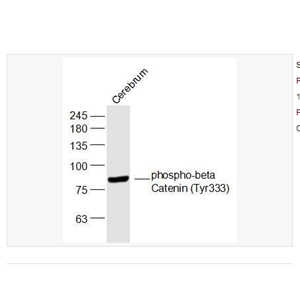 Anti-phospho-beta Catenin  antibody-磷酸化β-连环蛋白/β-连环素/β链接素抗体