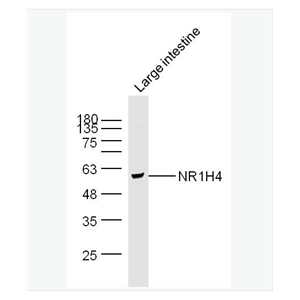 Anti-NR1H4 antibody-胆汁酸受体抗体