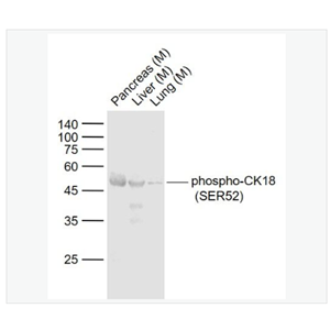 Anti-phospho-CK18  antibody-磷酸化细胞角蛋白18抗体,phospho-CK18 (Ser52)