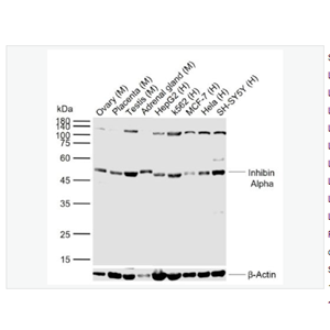 Anti-Inhibin Alpha antibody-抑制素α/Inhibin α抗体,Inhibin Alpha