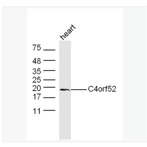Anti-C4orf52 antibody-4号染色体开放阅读框52抗体