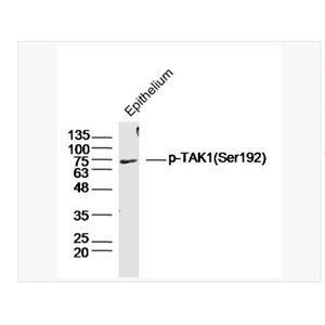 Anti-phospho-HSP70 antibody-磷酸化热休克蛋白-70抗体,phospho-HSP70 (Tyr41)