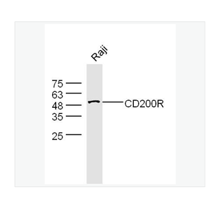 Anti-CD200R antibody-CD200受体抗体