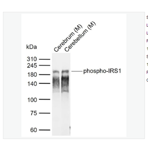 Anti-phospho-IRS1  antibody-磷酸化胰岛素受体底物1抗体