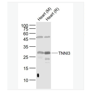 Anti-TNNI3  antibody-心肌肌钙蛋白I抗体