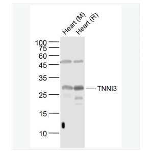 Anti-TNNI3  antibody-心肌肌鈣蛋白I抗體,TNNI3