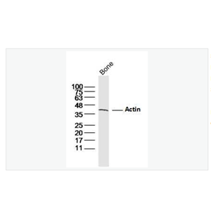 Anti-Actin  antibody-肌动蛋白α1抗体
