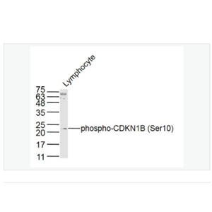 Anti-phospho-CDKN1B antibody-磷酸化P27抗体/周期素依赖激酶抑制剂