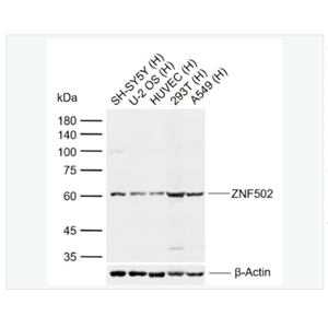 Anti-ZNF502 antibody-锌指蛋白502抗体