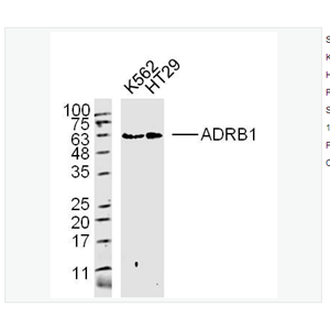 Anti-ADRB1 antibody-肾上腺素能受体β1抗体