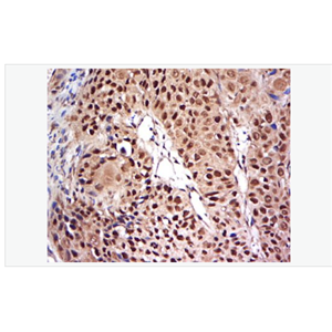 Anti-NFKB p65  antibody-细胞核因子/k基因结合核因子抗体