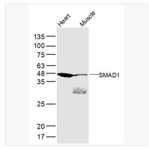 Anti-SMAD1 antibody-细胞信号转导分子Smad-1抗体,SMAD1