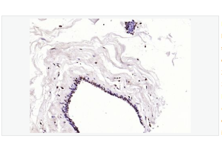 Anti-Phospho-BRCA1 antibody-磷酸化乳腺癌易感基因1抗体,Phospho-BRCA1 (Ser1466)