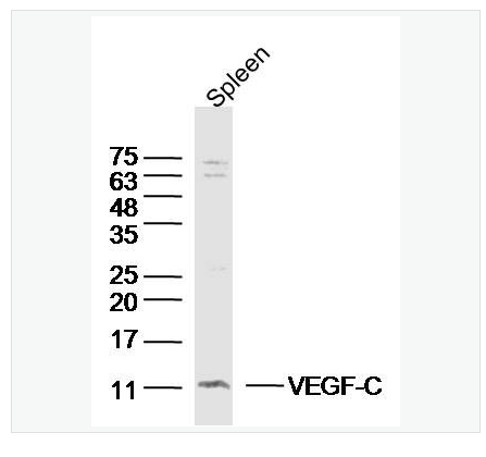 Anti-MMP-2 antibody-基质金属蛋白酶2抗体,MMP-2