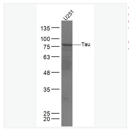 Anti-Tau  antibody-微管相关蛋白抗体,Tau
