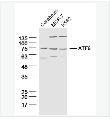 Anti-ATF6  antibody-活化转录因子6抗体,ATF6