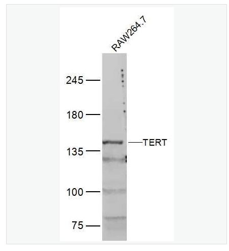 Anti-TERT  antibody-端粒酶逆转录酶抗体,TERT