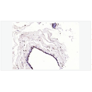 Anti-Phospho-BRCA1 antibody-磷酸化乳腺癌易感基因1抗体,Phospho-BRCA1 (Ser1466)