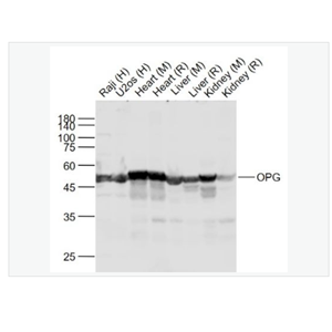 Anti-OPG  antibody-骨保护蛋白/护骨素抗体