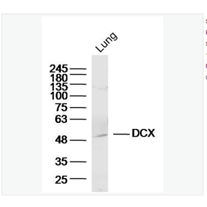 Anti-DCX/Doublecortin antibody-双皮质素抗体