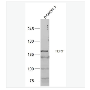 Anti-TERT  antibody-端粒酶逆转录酶抗体