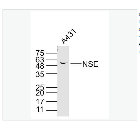 Anti-NSE antibody-神经元特异性烯醇化酶单克隆抗体,NSE
