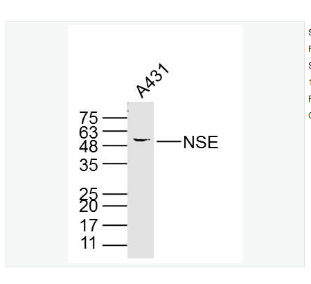 Anti-NSE antibody-神經元特異性烯醇化酶單克隆抗體,NSE