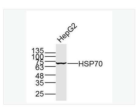 Anti-HSP70  antibody-热休克蛋白-70单克隆抗体,HSP70