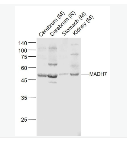 Anti-SMAD7 antibody-Smad7抗體,SMAD7