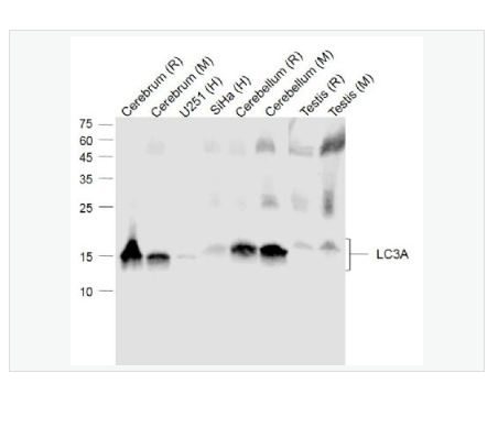 Anti-LC3A  antibody-自噬微管相关蛋白轻链3单克隆抗体,LC3A