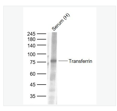 Anti-Transferrin antibody-转铁蛋白（内参）单克隆抗体,Transferrin(Serum Loading Control)