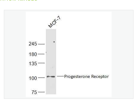 Anti-Progesterone Receptor antibody-孕激素受体抗体,Progesterone Receptor