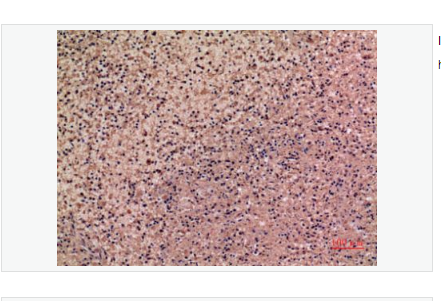 Anti-IL-28 antibody-白細胞介素28抗體,IL-28