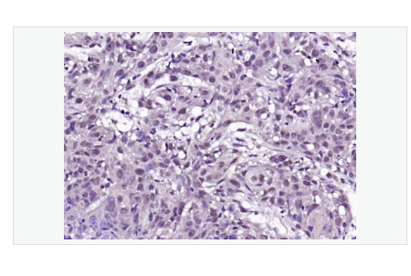 Anti-BRAF antibody-B Raf抗體,BRAF