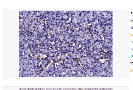 Anti-CD105 antibody-CD105抗體,CD105