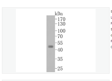 Anti-Aurora A  antibody-有絲分裂激酶A與重組兔單克隆抗體,Aurora A