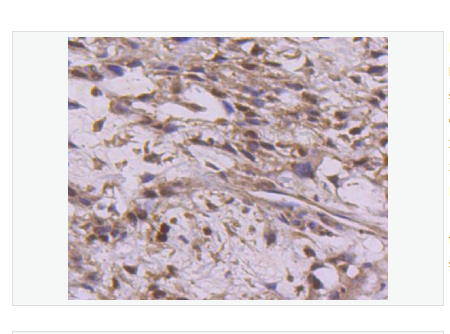 Anti-Cyclin E2  antibody-周期素E2重组兔单克隆抗体,Cyclin E2