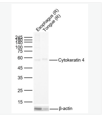 Anti-Cytokeratin 4 antibody-细胞角蛋白4重组兔单克隆抗体,Cytokeratin 4