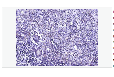 Anti-phospho-EGFR  antibody-磷酸化表皮生長因子受體重組兔單克隆抗體,phospho-EGFR (Ser695)